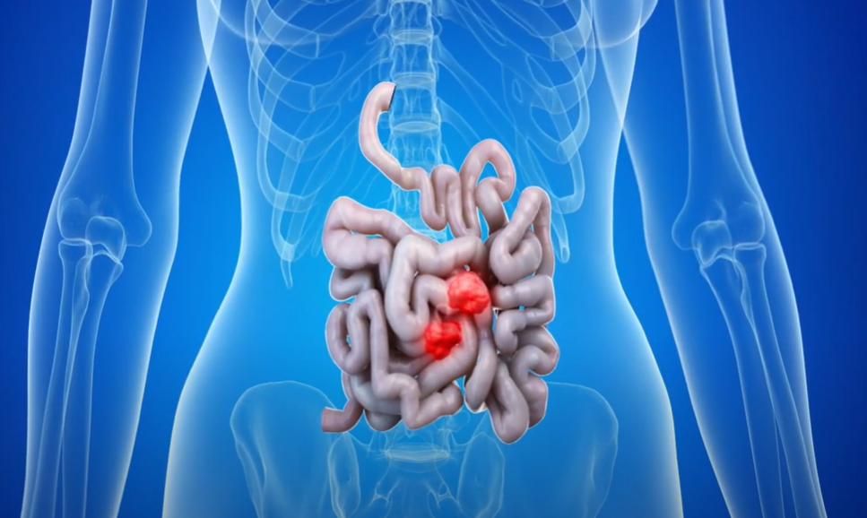 graphic illustration showing the human gut
